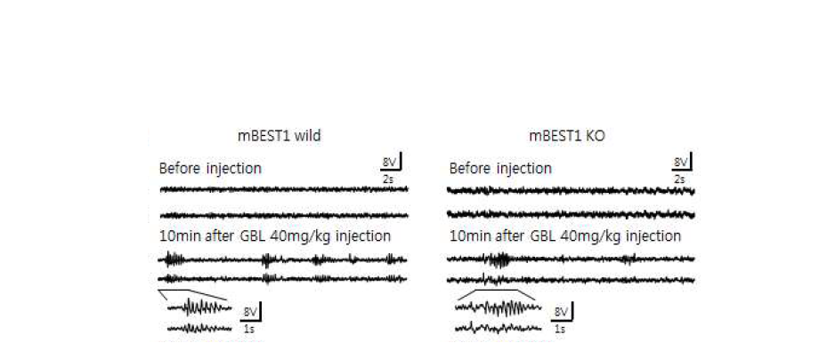 γGBL에 의해 유도된 정상생쥐와 mBEST1 KO 생쥐의 SWDs 패턴