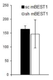 시상에 바이러스 주입 후 Lethargic 생쥐에게서 나타나는 SWDs duration 측정