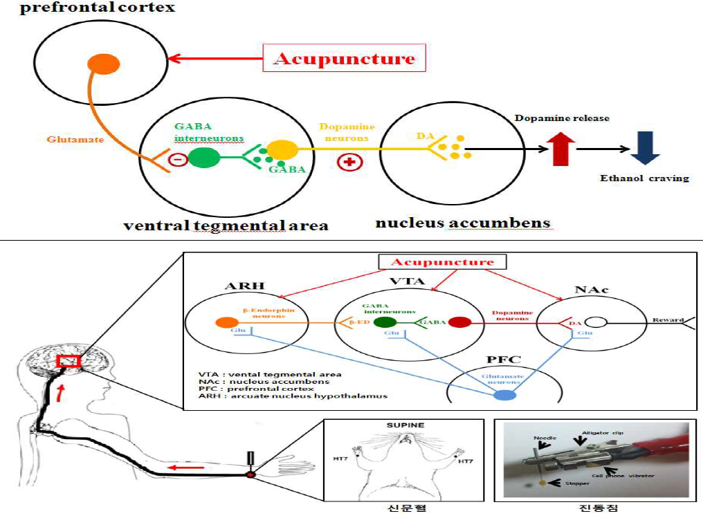신문혈침자극의 전전두엽 활성화를 통한 알코올 중독재발 제어 예상 기전
