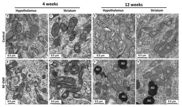 Analysis of mitochondria structure in neuron of hypothalamus and striatum between control- and radiofrequency-exposed mice.