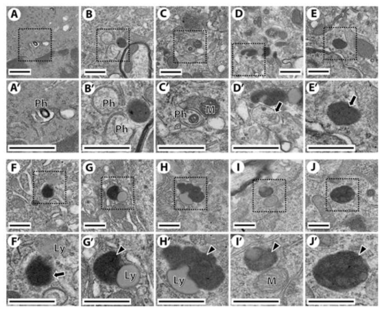 A series of representative TEM images showing the presumed progressing of the autophagosomic-lysosomal degradation in the Striatum of mice following three month RF-EMF exposure.