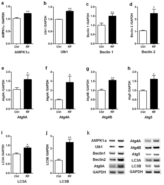 Expressional levels of autophagy related genes in the cerebral cortex of chronic RF-EMF exposure.