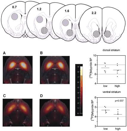 충동성이 정상적인 쥐 (A, C)와 높은 쥐에 (B, D)서의 뇌의 Dorsal Striatum (A, B) 과 Ventral Striatum, 즉 Nucleus Accumbens (NAc, 중격의지핵, C, D) 에서의 도파민 수용체 D2 신호의 차이