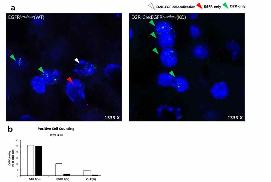 제자리형광잡종화(FISH, FluoreScence in situ hybridization) 기법을 이용하여 조건적 유전자 결손을 확인함.