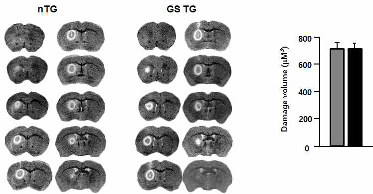 MR analysis of ATP-induced damage in non-TG and GS-TG mouse brain.