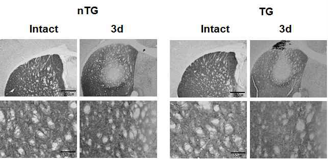 Damage of TH-positive neurites were anlyzed in ATP-injected striatum.