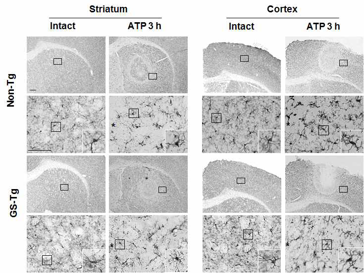 Effect of GS mutation on microglial responses in injured brain.