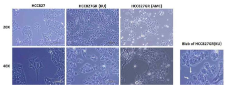 모세포와 저농도의 제프티닙을 6개월 이상 처리하거나 HCC827GR(AMC) 고농도의 제프티닙을 2개월 이상 처리하여 HCC827GR(KU) 구축된 제프티닙 내성 세포주. 화살표는 bleb의 형태를 표시함.