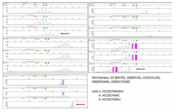 Microsatellite instability analysis with 5 markers. 화살표는 불안정해진 마커를 표시함.