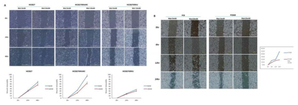 세포 이동성 분석 (wound healing analysis). 메포민의 모세포 및 제프티닙 내성 세포주에서 이동성 억제 효과. A. HCC827, HCC827GRAMC, HCC827GRKU 메포민 처리 전 후 B. PC9, PC9GR 메포민 처리 전 후.