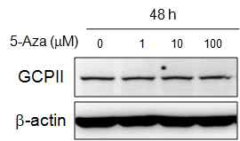 5-Aza 처리에 의한 GCPII 발현 변화