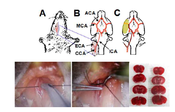 마우스에서 경동맥 (ICA)부분을 결박하는 방법