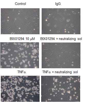 ICAM1에 의한 leukocyte adhesion 조절