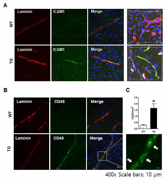 AD transgenic mouse와 Wild type B6C3-Tg 마우스의 뇌에서 ICAM-1과 laminin의 co-localization (A). AD transgenic mouse의 뇌에 주입된 labelled neutrophil 의 infiltration (B).