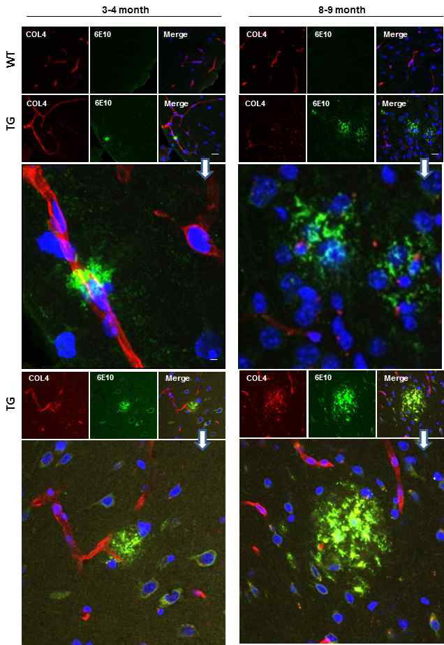 AD transgenic mouse와 Wild type B6C3-Tg 마우스의 뇌혈관에서의 Aβ축적