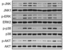 Regulation of RANKL-induced signaling pathways by EF-L1.