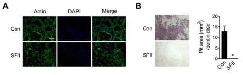 SFII inhibits actin ring formation and bone resorption.