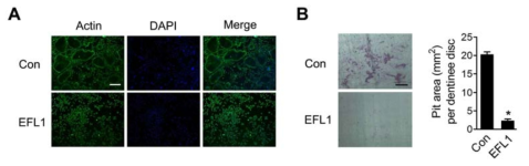 EFL1 inhibits actin ring formation and bone resorption.