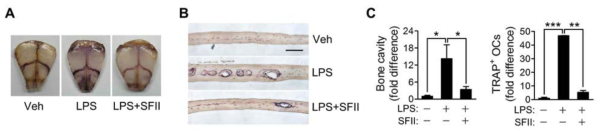 Inhibition of LPS-induced bone destruction by SFII.