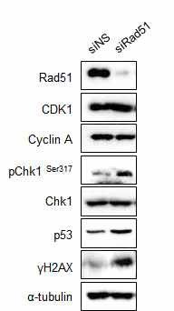 Rad51 발현억제에 따른 DNA Damage Checkpoint Activation