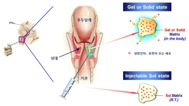 본 연구팀에서 제안하는 손상된 성대 재건을 위한 생물학 제제 탑재 고분자 주사제의 모식도