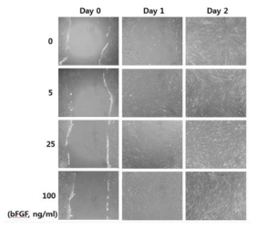 bFGF 처리에 따른 인간 성대세포의 이동성 증가.