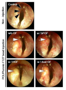 성대 마비 동물 모델에 성장인자 탑재 주사제를 주입한 성대 조직 모습.