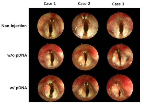 pDNA 탑재 고분자 메트릭스 주사제를 주입한 후두 내시경 소견 비교.