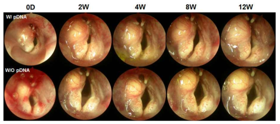 pDNA 탑재 고분자 메트릭스 주사제를 주입한 후두 내시경 소견 비교.