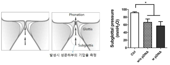 성대 성문하부의 기압측정을 통한 성대의 기능성 평가.