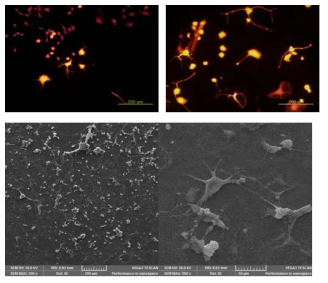 나노선 소자 상에 배양된 다중 뉴런 세포의 형광이미지(위)와 SEM이미지(아래)