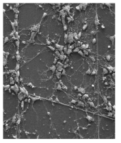 신경소자 상에서 배양된 신경세포의 SEM사진