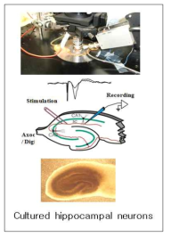 Organotypic brainslice recording settings