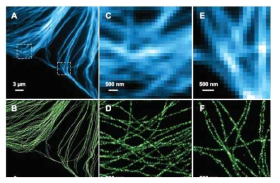 Mammalian cell 안의 microtubules의 일반 면역 형광이미지(A) 와 STORM 이미지(B