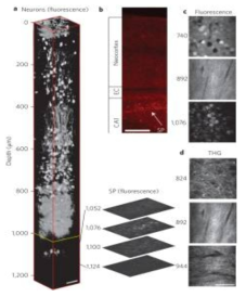 Mouse 뇌의 신경세포의 삼광자 현미경(3PM) 이미지