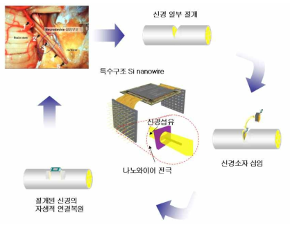 나노와이어 기반 신개념 지능형 신경소자의 임상적용