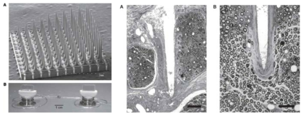 Utah multi-electrode array와 고양이의 Sciatic 신경에 삽입된 모습.