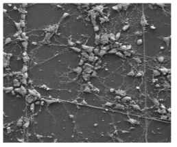 신경소자 상에서 배양된 신경세포의 SEM사진