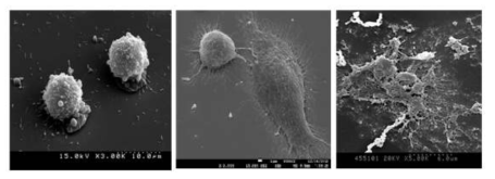 나노선 소자 상에 배양된 GH3 세포(좌), PC-12 cell line(중앙), NPC(우) 의 SEM 이미지