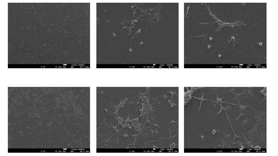 나노선 위에서 전기적 자극 없이 6일간 배양된 PC-12 cell (위) 및 나노선을 통해 세포 내부로 50mV의 전기적 자극을 4 일과 전달한 후 추가적으로 2일 더 배양된 PC-12 cell (아래) 의 SEM 이미지