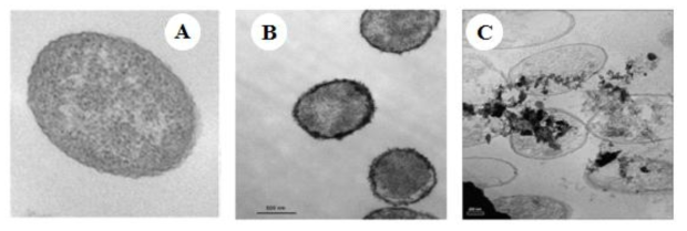 나노영가철의 처리가 토양세균인 Pseudomonas stutzeri에 살균효과 입증 TEM 사진.