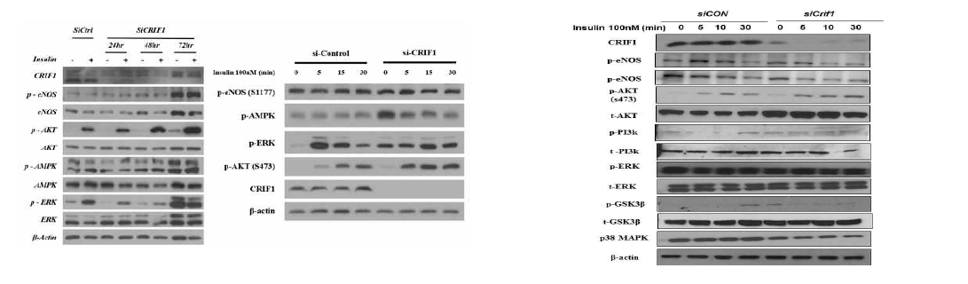 CRIF1 결손 내피세포의 Insulin signaling 이상