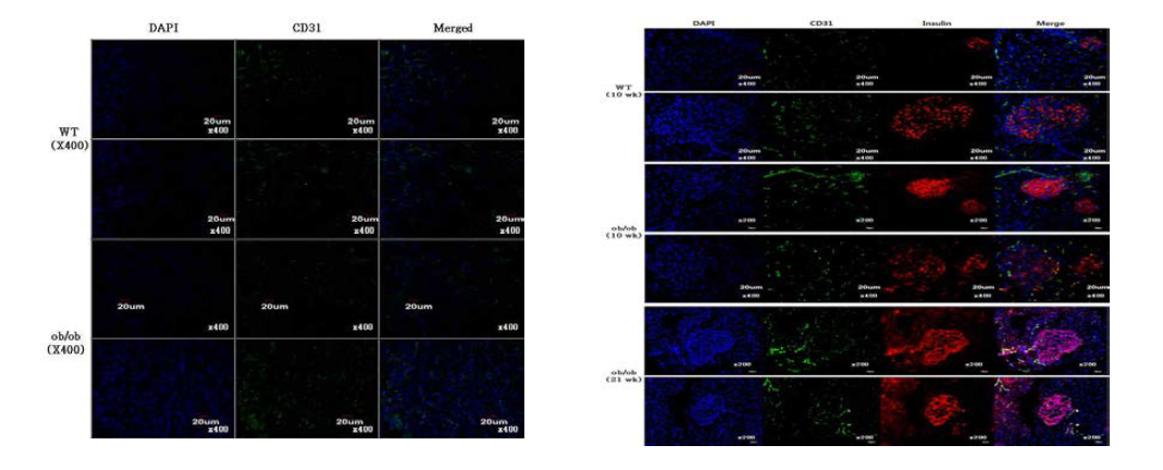 ob/ob 마우스의 신장 및 췌장미세혈관 구조 관찰