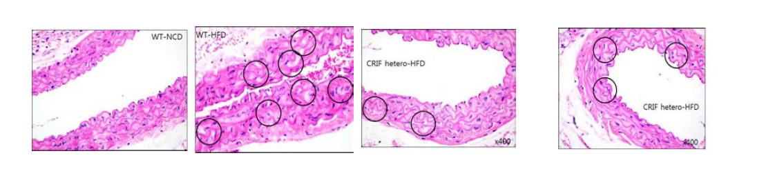 혈관내피세포 특이 CRIF1 유전자이상 마우스(Crif1 EC+/-)의 조직학적 변화