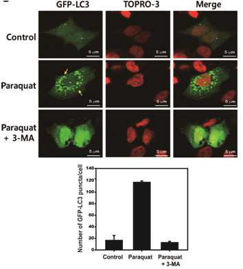 망막색소상피세포의 Paraquat 처리에 의한 autophagy 활성 증가 확인. 형광현미경을 이 용한 GFP-LC3 발현 검증과 이의 정량(puncta counting).