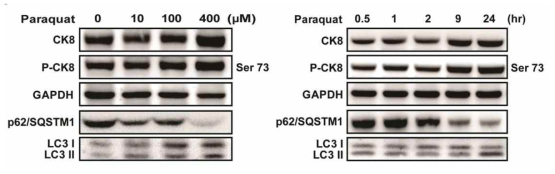 망막상피세포의 산화스트레스에 따른 autophagy 표적 단백질의 발현 확인 및 CK8 단백질 발 현 확인