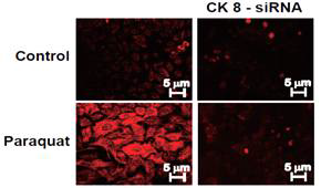 siRNA를 이용한 Cytokeratin 8 발현 억제확 인 (immunocytochemistry).