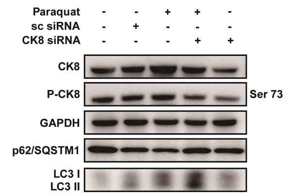 siRNA를 이용한 Cytokeratin 8 발현 억제확 인 (Western blot assay).