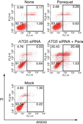 ATG5 siRNA 처리 후 산화스트 레스에 의한 망막상피세포의 세포사멸이 급증함을 관찰