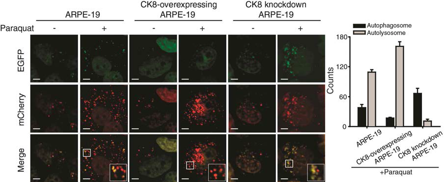 산화스트레스로 유발된 망막세포의 자가포식작용에서 케라틴8은 자가소화포 형성을 증가시킴.